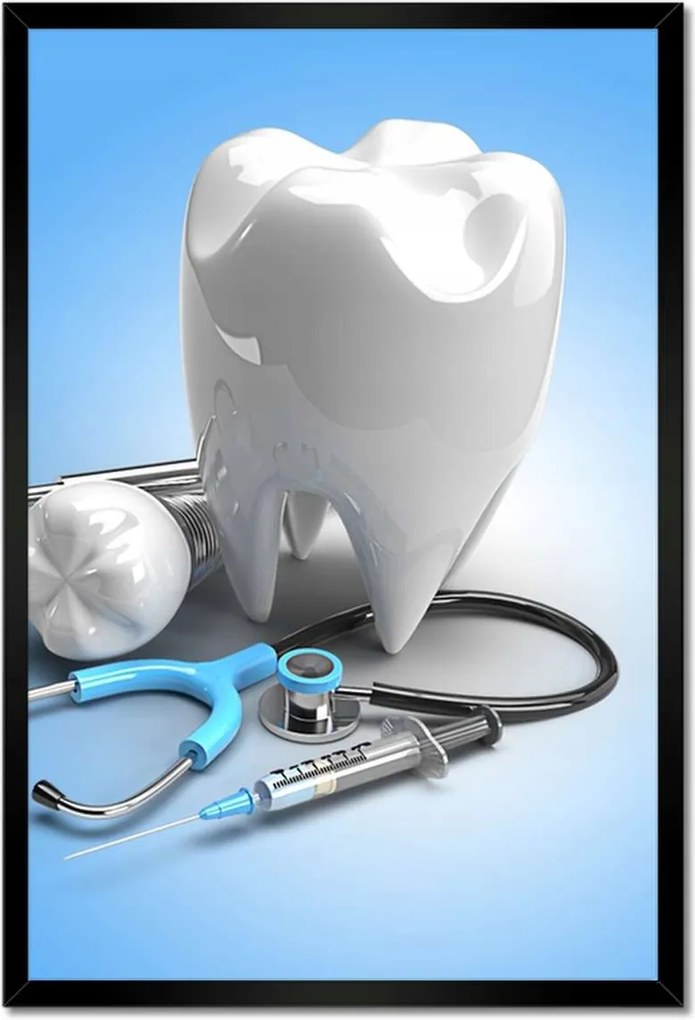 Plakátok keretben 40x60 Fogászati implantátumok fog