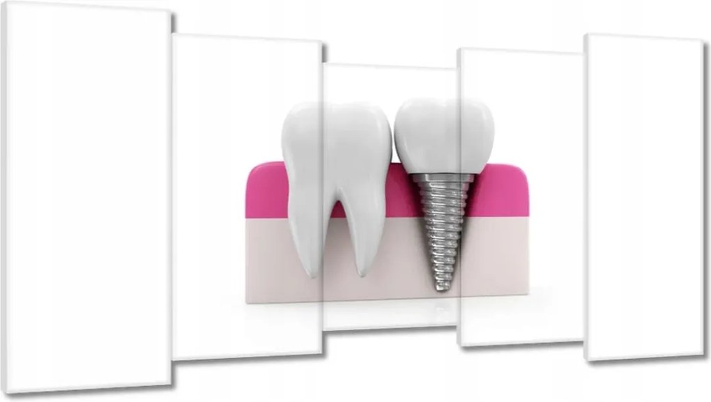 Festmények 150x80 Természet vs ember