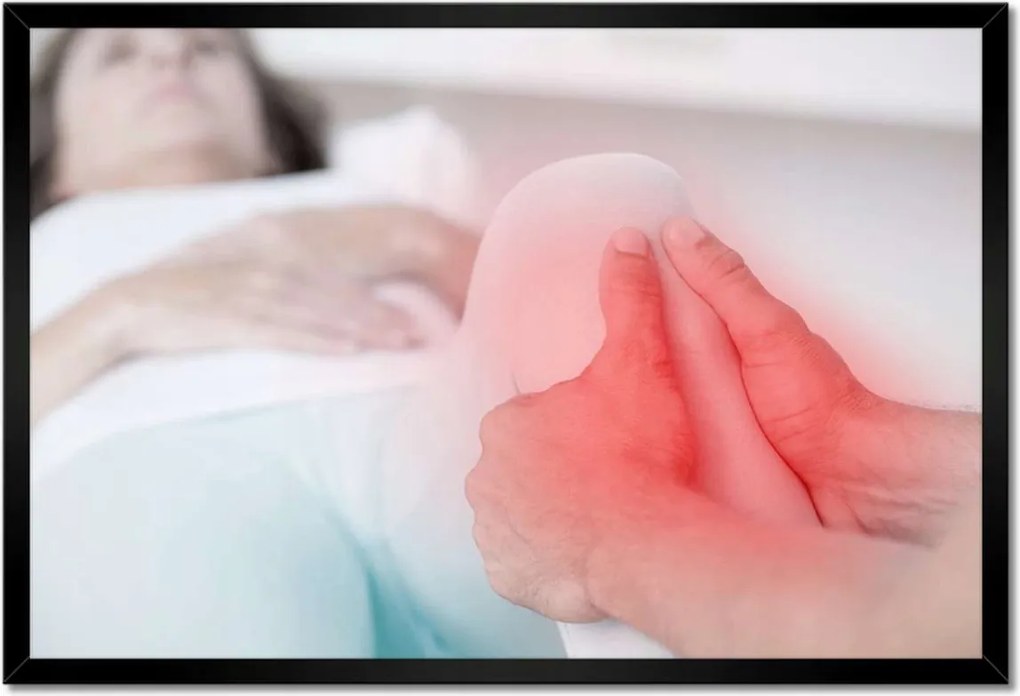 Poszterek keretben 60x40 Térdízületi reteszelés