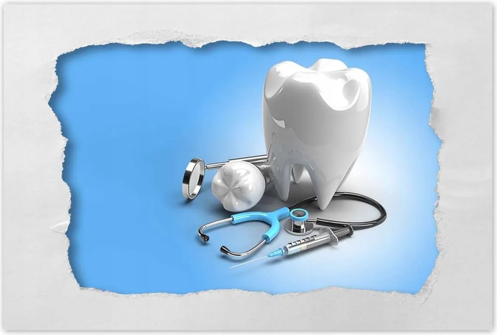 Poszterek 90x60 Fogászati implantátumok fog