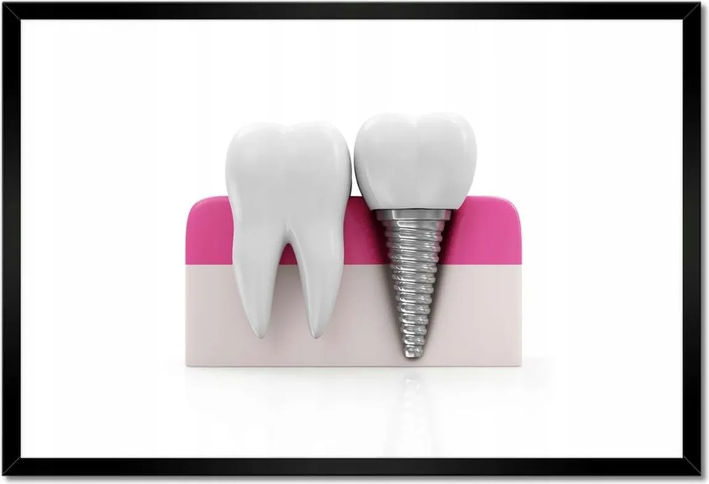 Poszterek keretben 60x40 Természet vs ember