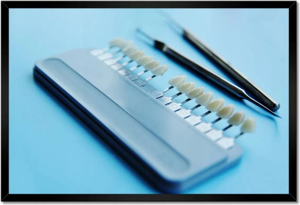 Poszterek keretben 60x40 Fogimplantátum mintavevő