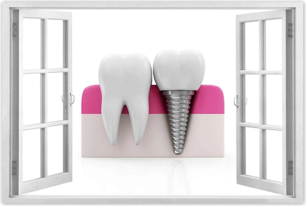 Poszterek 120x80 Természet vs ember