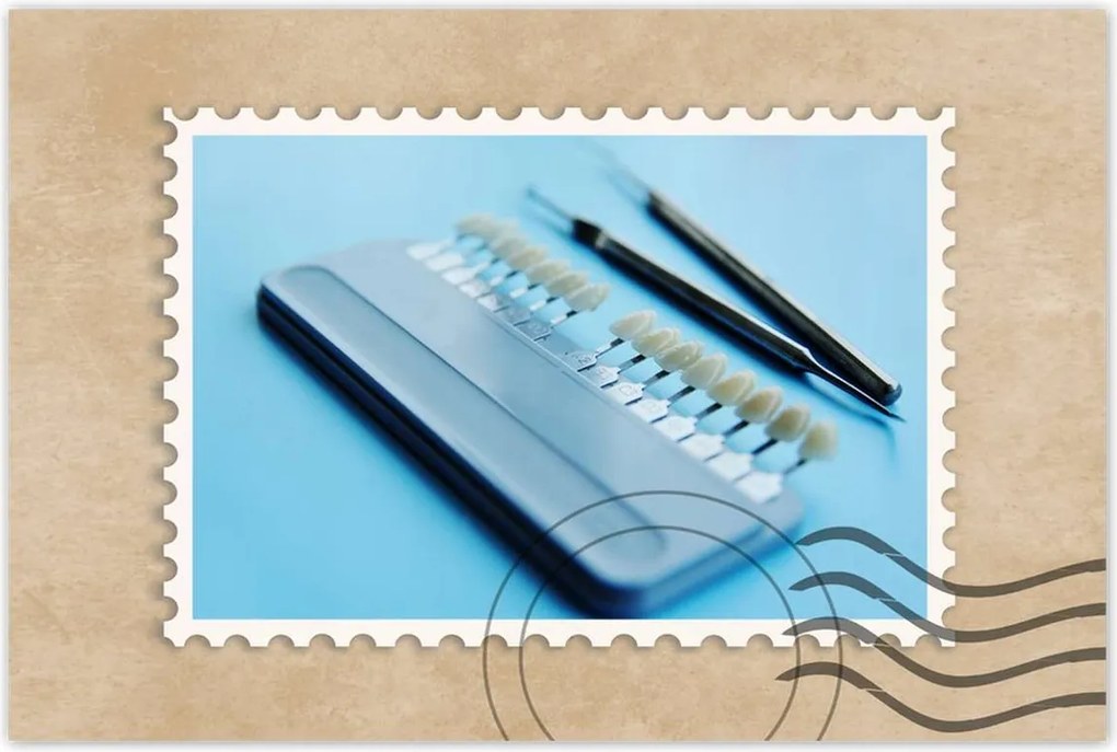 Poszterek 90x60 Fogimplantátum mintavevő