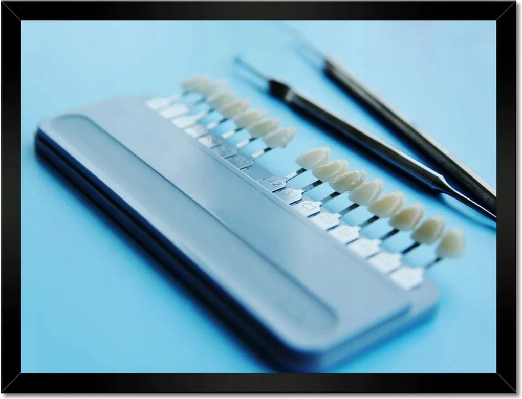 Poszterek keretben 40x30 Fogimplantátum mintavevő