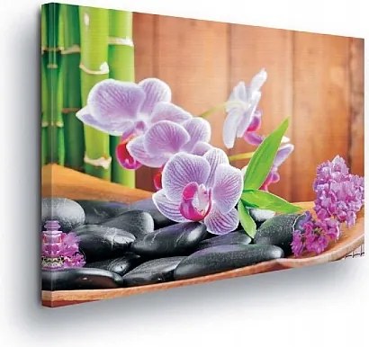 Vászonkép 100x75 Orchideák fekete kövekben – harmónia és pihenés az Önben