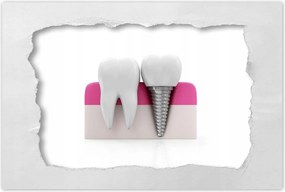 Poszterek 60x40 Természet vs ember