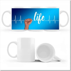 Életvonal fényképes bögre