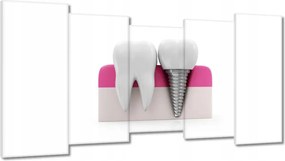 Festmények 150x80 Természet vs ember