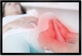 Poszterek keretben 60x40 Térdízületi reteszelés