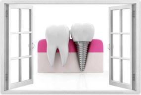 Poszterek 120x80 Természet vs ember