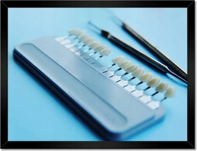 Poszterek keretben 40x30 Fogimplantátum mintavevő