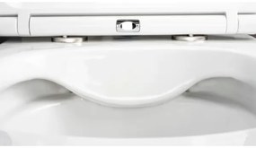 Deante CGRD6ZPW - Falra szerelhető WC SoftClose ülőkével, ROUND, kerámia/fehér