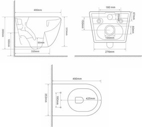 Delano fali rimless WC soft-close ülőkével fekete