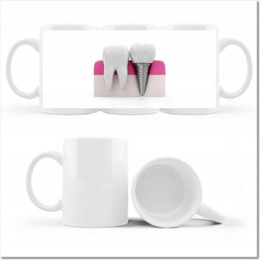 Nyomott mintás bögre Természet vs ember