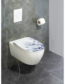 WC-ülőke automatikus záródással 36,5 x 45 cm Sereno – Wenko