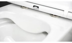 Deante CGRD6ZPW - Falra szerelhető WC SoftClose ülőkével, ROUND, kerámia/fehér