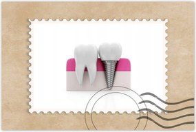 Poszterek 60x40 Természet vs ember